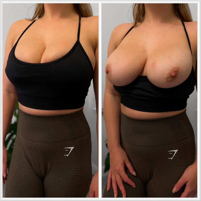 Huge collection of porn photos Big Tits Gym Huge Tits by Nick and Nicole’s (@nickandnicole)
